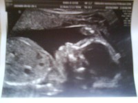 /album/ultrazvuky/a24-2-2-jpg/